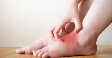 أسباب حكة أصابع القدمين